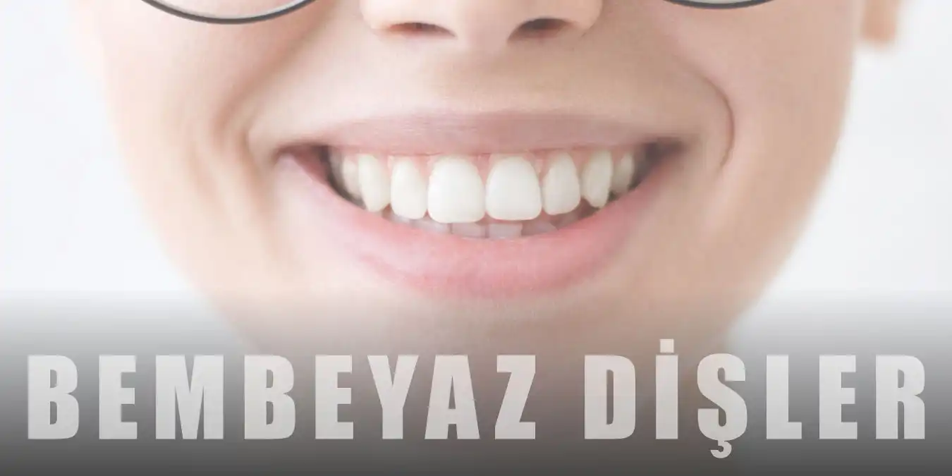 Diş Nasıl Beyazlatılır? Dişleri Beyazlatan 10 Yöntem