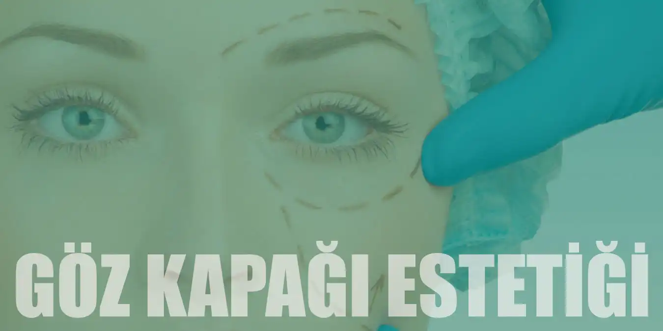 Göz Kapağı Estetiği Nedir ve Nasıl Yapılır?