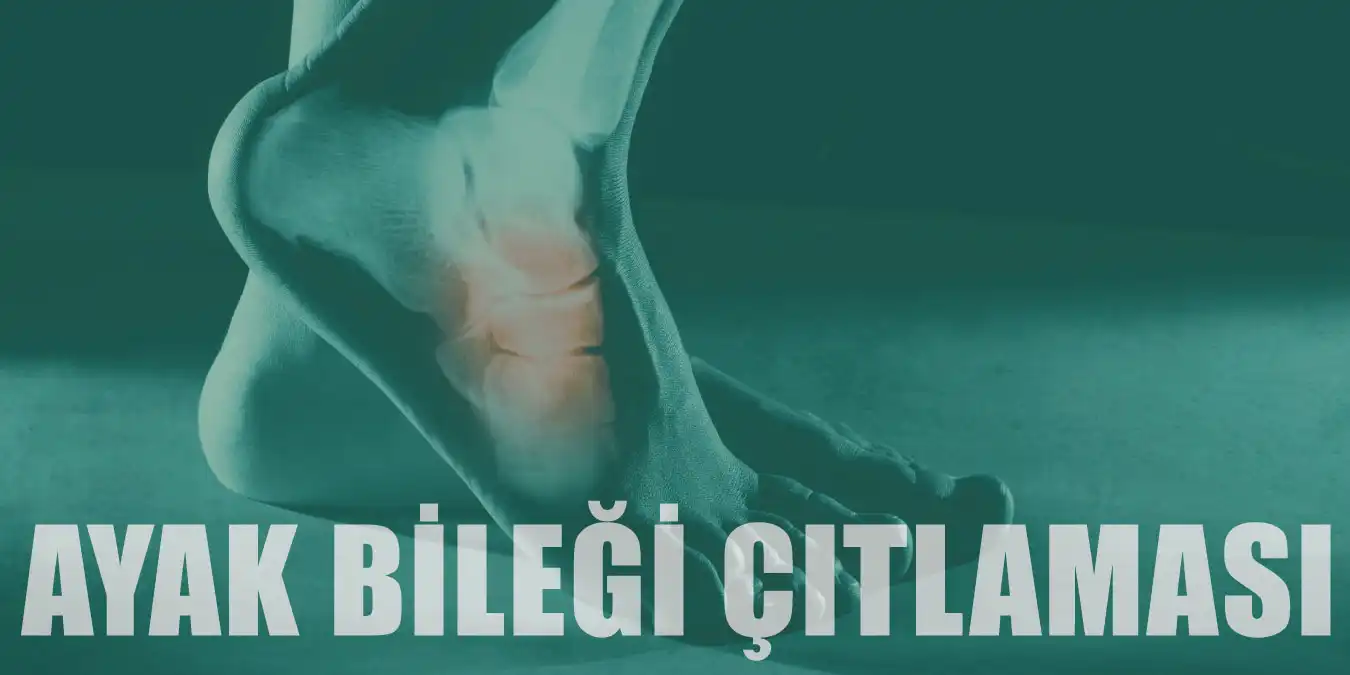 Ayak Bileğinin Çıtlaması Neden Olur ve Nasıl Geçer?