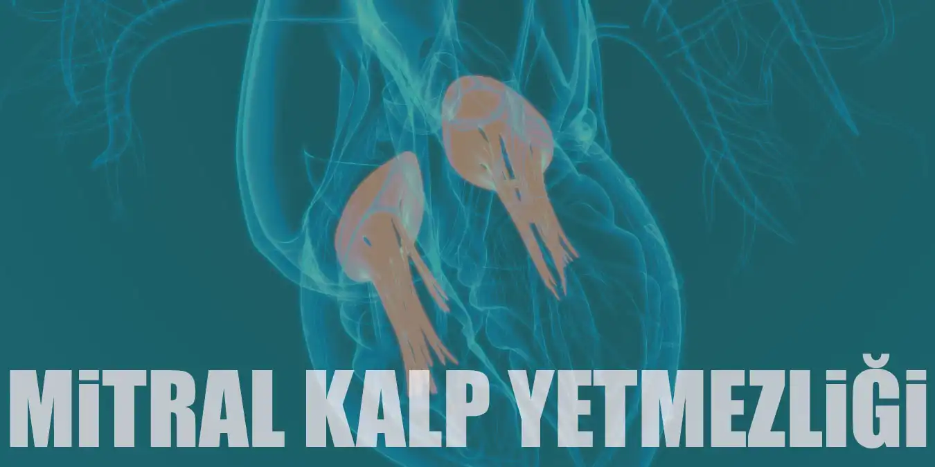 Mitral Kapak Yetmezliği Nedir? Belirtileri ve Tedavisi