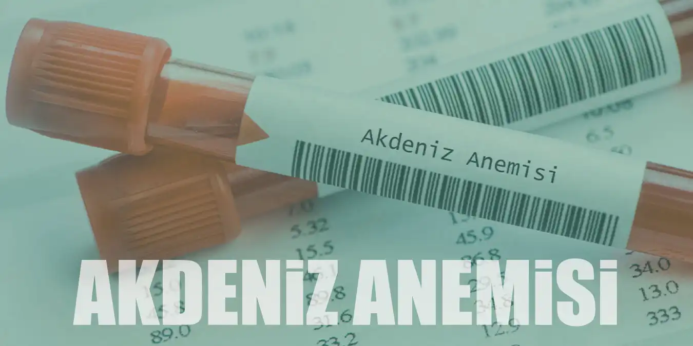 Akdeniz Anemisi Nedir, Belirtileri Nelerdir?