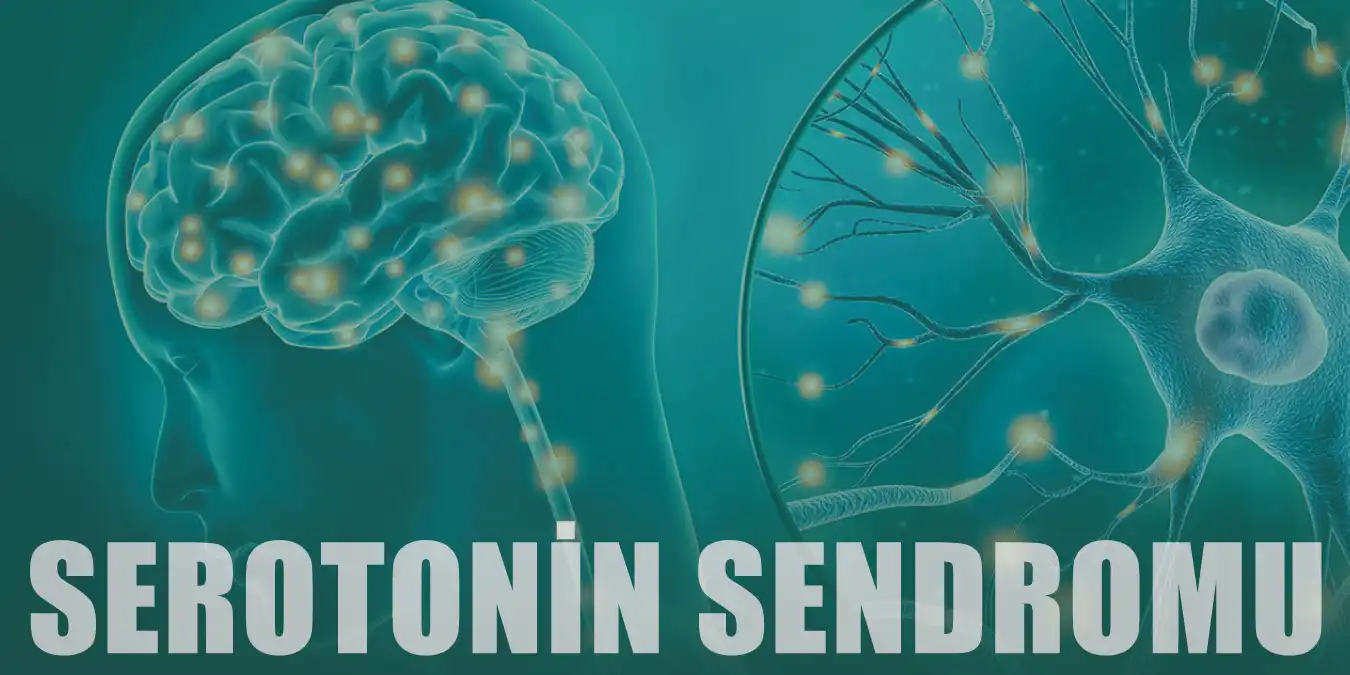 Serotonin Sendromu Nedir? Belirtileri, Nedenleri ve Tedavi Yöntemleri