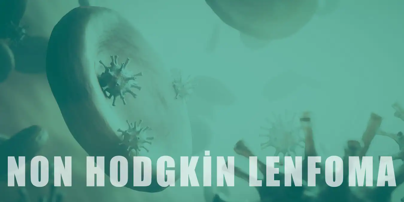 Non Hodgkin Lenfoma Nedir, Belirtileri ve Tedavisi Nelerdir?