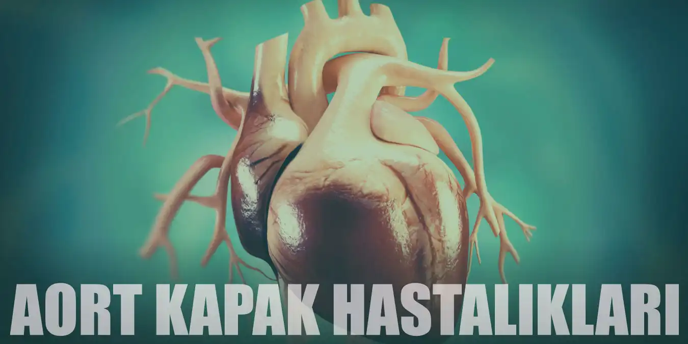 Aort Kapak Hastalıkları Nedir, Belirtileri Nelerdir?