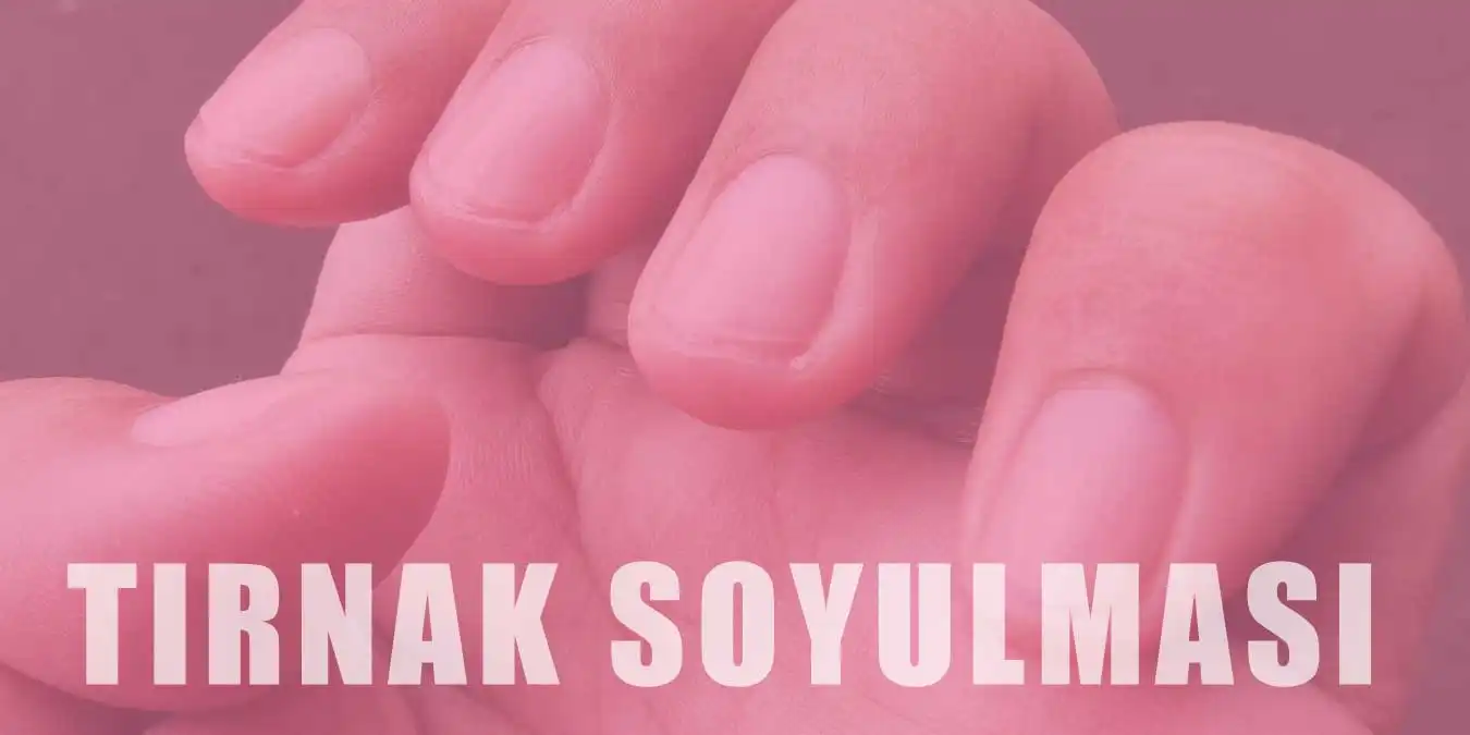 Tırnak Soyulmasının Nedeni Nedir? Nasıl Tedavi Edilir?