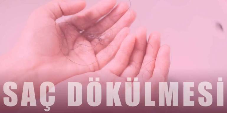 Kadın Tipi Saç Dökülmesi | Kadınlarda Saç Dökülmesinin 12 Nedeni