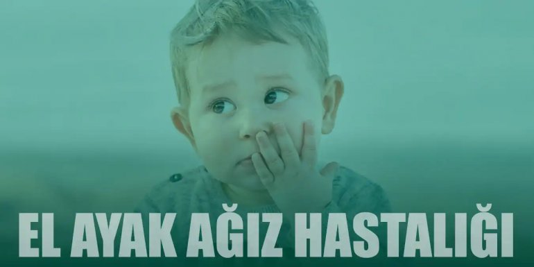 El Ayak Ağız Hastalığı Nedir? Belirtileri ve Tedavisi