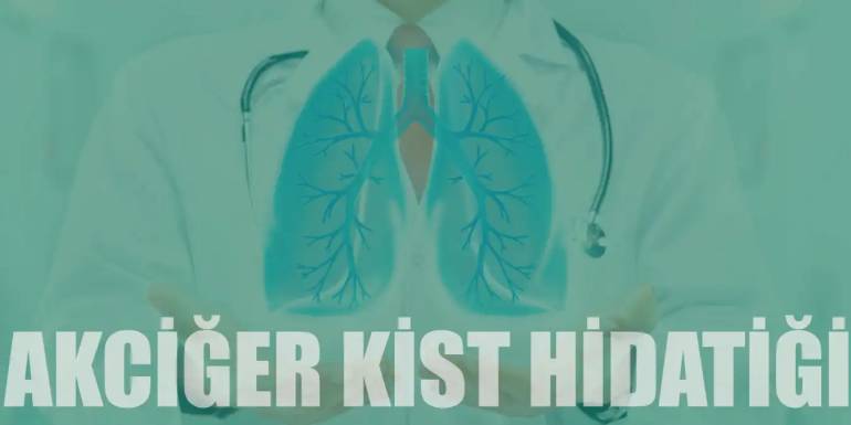 Akciğer Kist Hidatik Nedir? Belirtileri ve Tedavisi