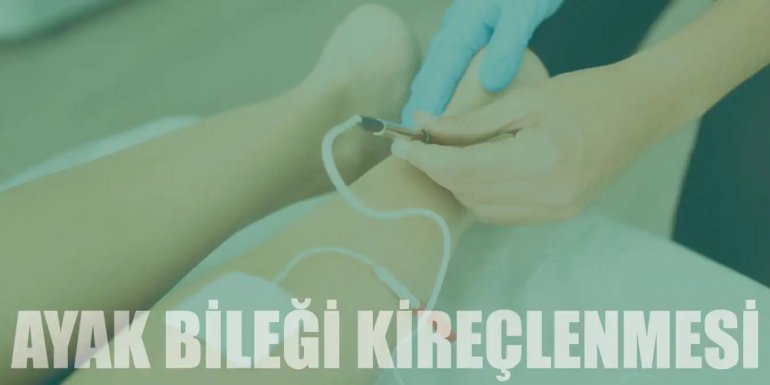 Ayak Bileği Kireçlenmesi Nedir? Belirtileri ve Tedavisi