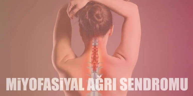 Miyofasiyal Ağrı Sendromu Nedir? Belirtileri ve Tedavisi