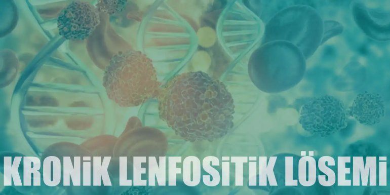 Kronik Lenfositik Lösemi Nedir? KLL Belirtileri ve Tedavisi