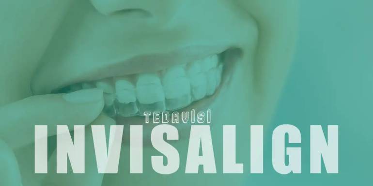 İnvisalign Nedir? Şeffaf Plaklarla Diş Düzeltme Süreci ve Avantajları