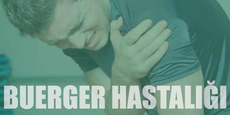 Buerger Hastalığı Nedir? Belirtileri ve Tedavisi Nelerdir?