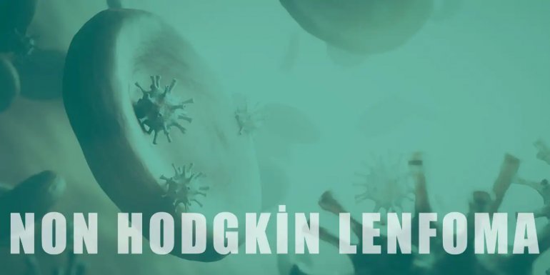 Non Hodgkin Lenfoma Nedir, Belirtileri ve Tedavisi Nelerdir?