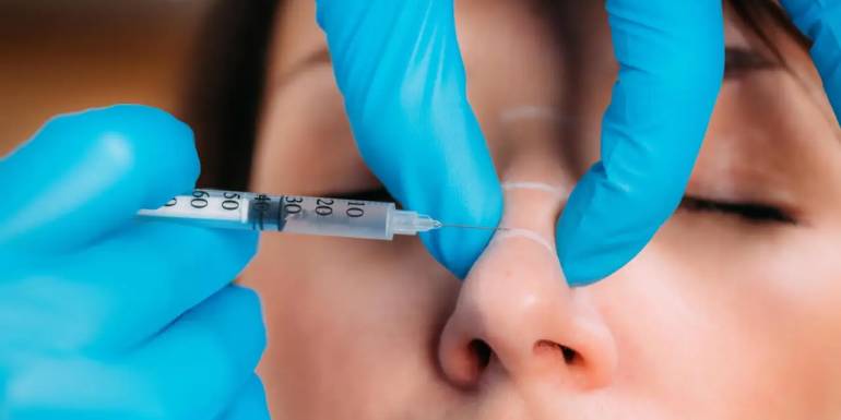 Burun Dolgusu Fiyatları: Esteworld’ün Farkı ile Burun Estetiğinde Yenilik