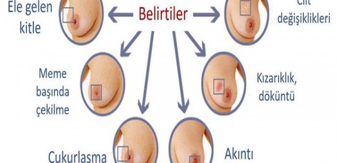 belirtileri-002.jpg