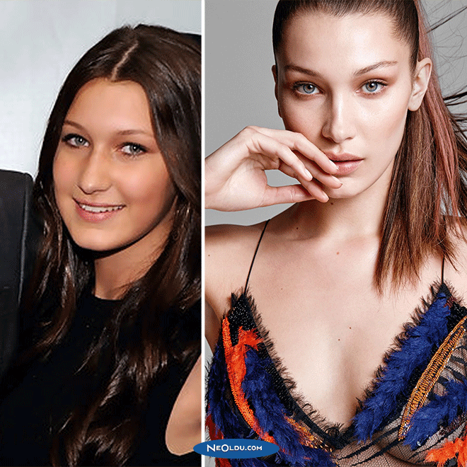 Bella Hadid Eski Hali