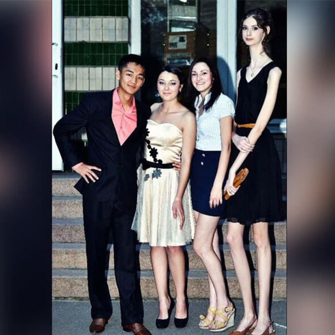 Dünya'daki En Uzun Boylu Kadın; Lyudmila Titchenkova Dünya'daki En Uzun Boylu Kadın; Lyudmila Titchenkova