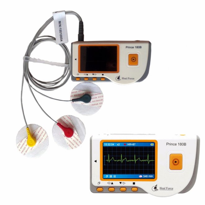 ekg-002.jpg