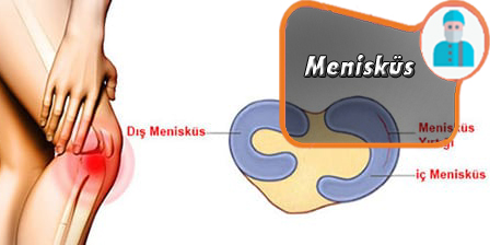 meniskus.jpg