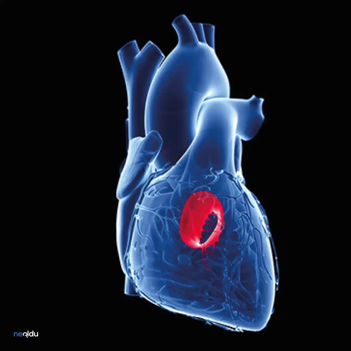 Mitral Kapak Hastalıkları