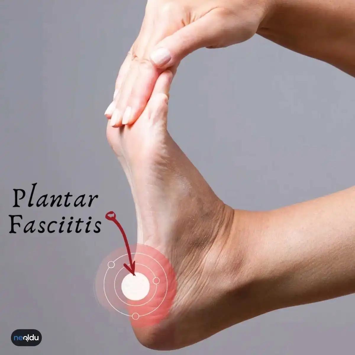 Plantar Fasiit